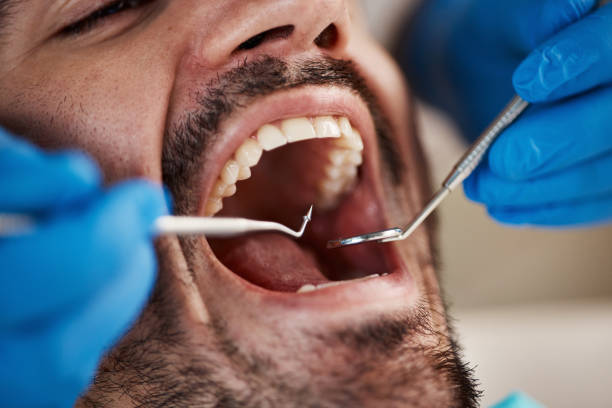 Best Emergency Dental Extractions in South Connellsville, PA