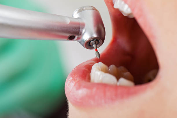 Best Broken or Cracked Tooth Emergency Dentist in South Connellsville, PA